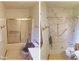 Before & After Photo 75